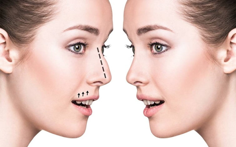 10-reasons-why-dr-sinha-is-highly-recommended-for-rhinoplasty