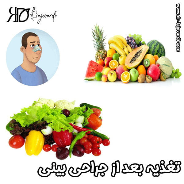 تغذیه بعد از جراحی بینی - دکتر محمد لاجوردی