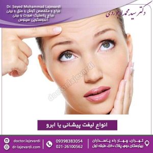 انواع لیفت پیشانی یا ابرو