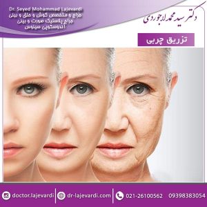 تزریق چربی