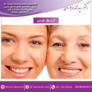 تزریق چربی