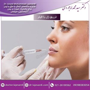 تزریق ژل یا فیلر