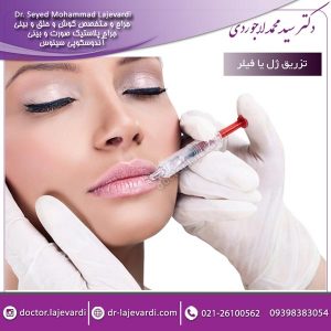 تزریق ژل یا فیلر