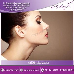 جراحی بینی فانتزی