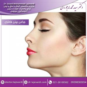 جراحی بینی فانتزی