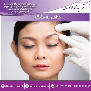 جراحی پلاستیک