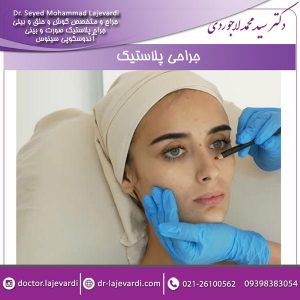 جراحی پلاستیک