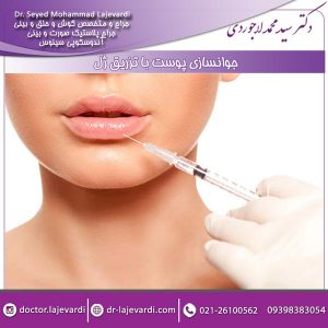 جوانسازی پوست با تزریق ژل