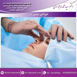 جراحی بینی باز