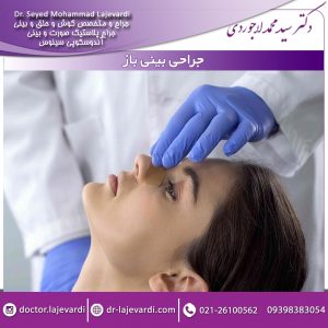 جراحی بینی باز