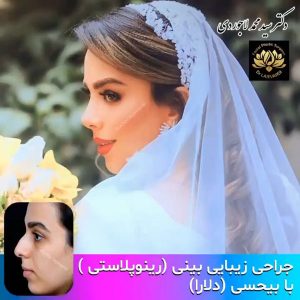 جراحی بینی - دکتر سید محمد لاجوردی