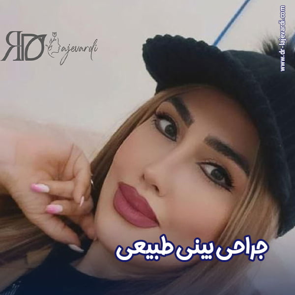 جراحی بینی طبیعی - دکتر محمد لاجوردی