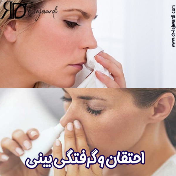 گرفتگی بینی بعد از جراحی بینی - دکتر محمد لاجوردی