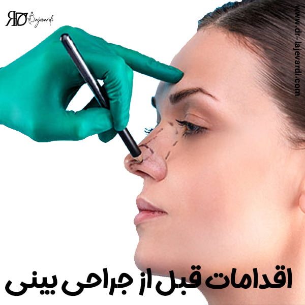 اقدامات قبل از جراحی بینی - دکتر محمد لاجوردی