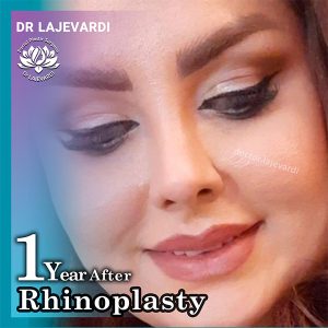 عمل بینی در تهران - دکتر محمد لاجوردی