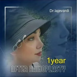 جراحی زیبایی بینی - دکتر محمد لاجوردی