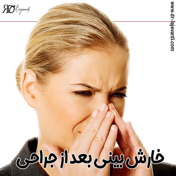 خارش بینی بعد از جراحی - دکتر محمد لاجوردی