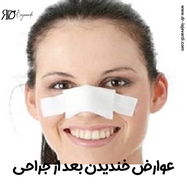 خندیدن بعد از جراحی بینی - دکتر محمد لاجوردی