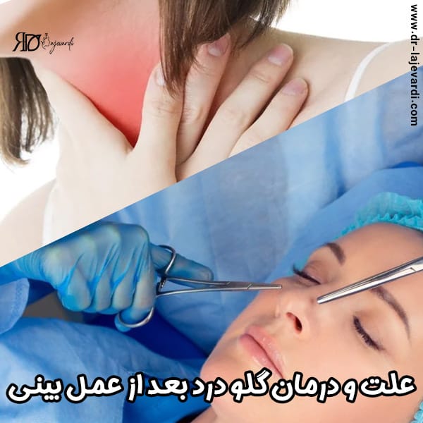 گلودرد بعد از جراحی بینی - دکتر محمد لاجوردی