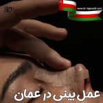 عمل بینی در عمان ؛ مراحل جراحی ، هزینه و مراقبت های بعد از عمل