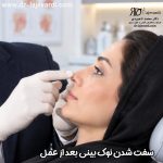 علت سفت شدن نوک بینی بعد از عمل جراحی و راه های درمان آن